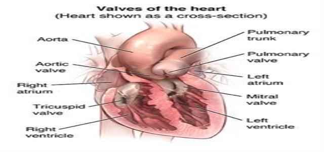 Heart Valve Complications