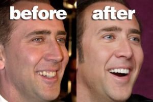 Fake Teeth Nicholas Cage