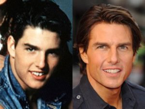 Fake Teeth Tom Cruise