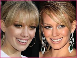 Famous Actresses Fake Teeth Hilary Duff
