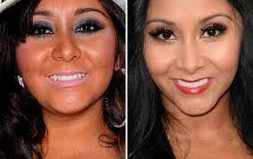 Famous Actresses Teeth Implants Snooki