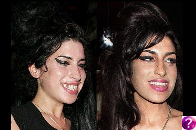 Amy Winehouse